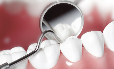 Periodoncia